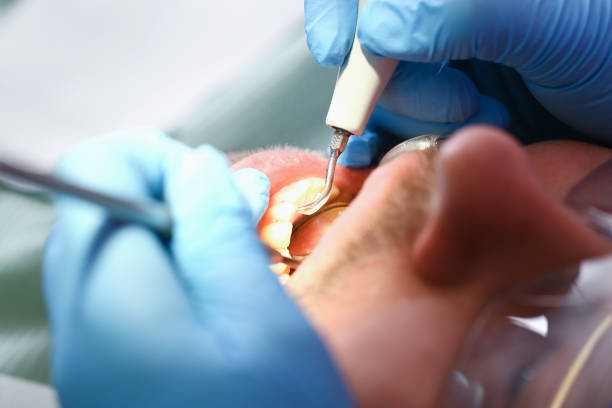 Best Emergency Treatment for Oral Infections in Sharon, PA