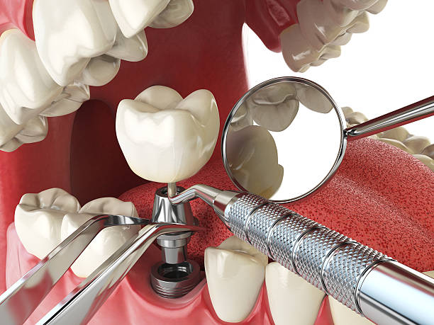 Best Walk-In Emergency Dental Services in Sharon, PA